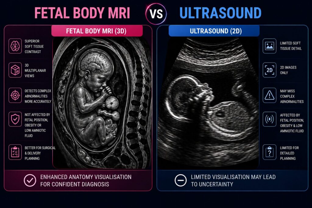 Difference between ultrasound and MRI